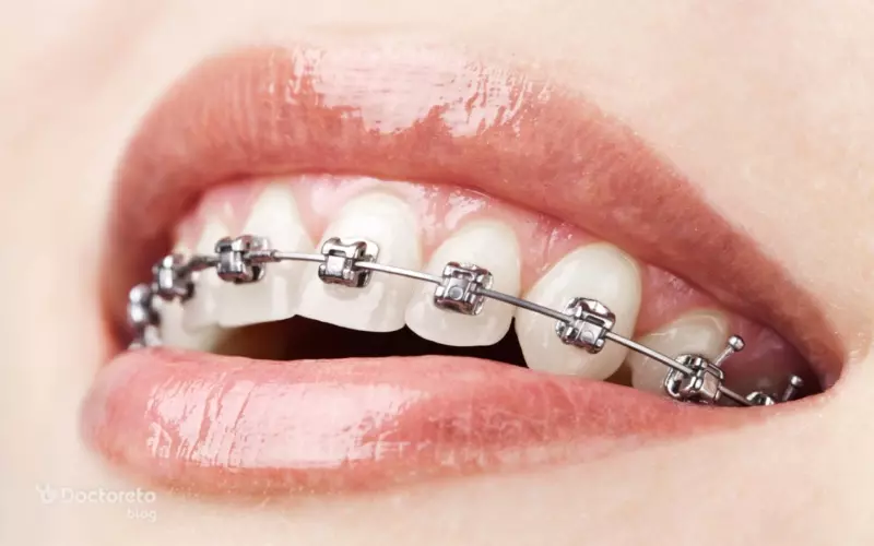 fixed orthodontics 1